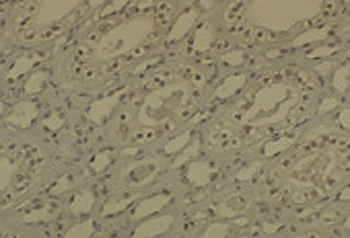 DNMT1 Antibody (HRP)
