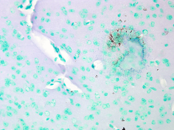 Cav1.2 Antibody (HRP)