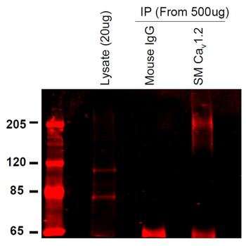 Cav1.2 Antibody (PerCP)