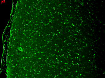 Cav1.3 Antibody (HRP)