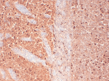 Cav3.2 Antibody (APC)