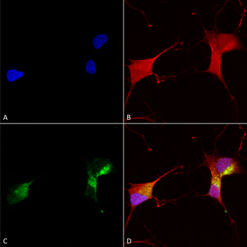 KCNQ1 Antibody (PerCP)