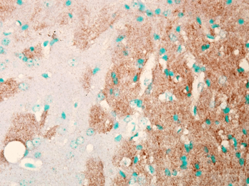 Nav1.7 Antibody (APC)