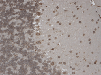 TRPM7 Antibody (APC)