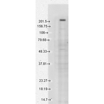 TRPM7 Antibody (APC)