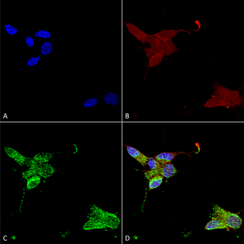 TRPM7 Antibody (Biotin)