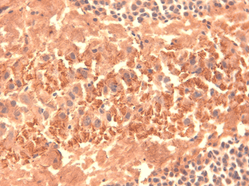 HCN4 Antibody (RPE)