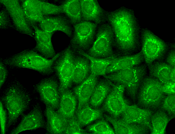 Slo2.2 Antibody (HRP)