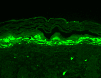 SHANK1 Antibody (RPE)