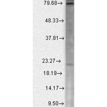 CavBeta2 Antibody (FITC)