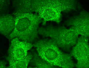 CavBeta2 Antibody (FITC)