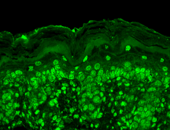 CavBeta2 Antibody (PerCP)