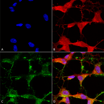 TRPV3 Antibody (APC)