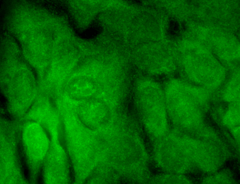 SHANK3 Antibody (HRP)