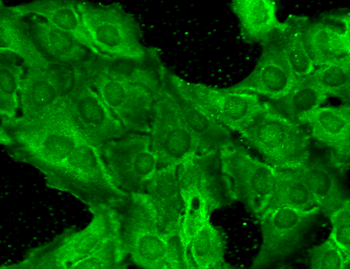 NR2B Antibody (Biotin)