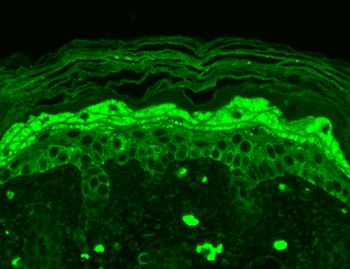 NR2B Antibody (Biotin)