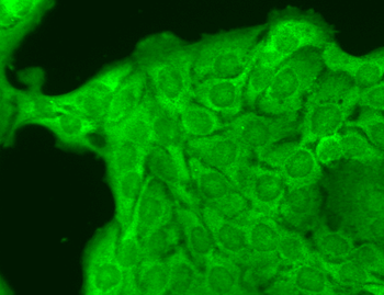 Nav1.8 Antibody (APC)