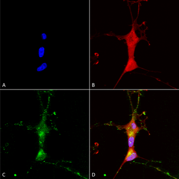 TRPC7 Antibody (HRP)