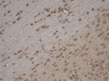 TRPC5 Antibody (RPE)