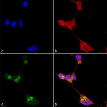 GABA A Receptor Antibody (FITC)