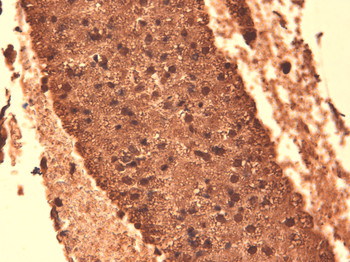 Sodium Iodide Symporter Antibody (HRP)