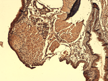 Sodium Iodide Symporter Antibody (HRP)