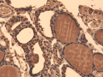 Sodium Iodide Symporter Antibody (PerCP)