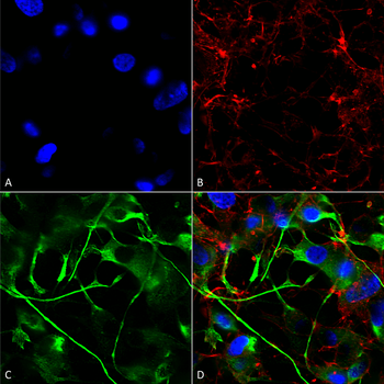VAChT Antibody (FITC)