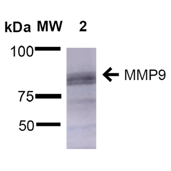 MMP9 Antibody (FITC)