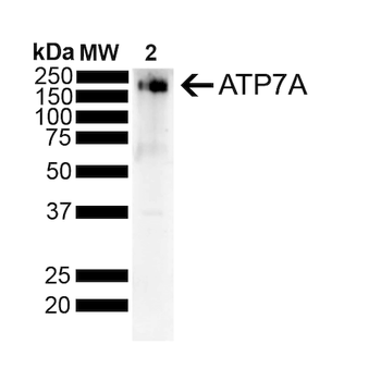ATP7A Antibody (RPE)