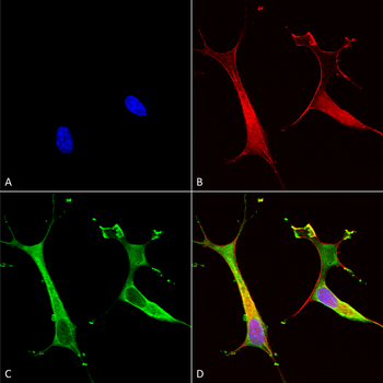 ATP7B Antibody (FITC)