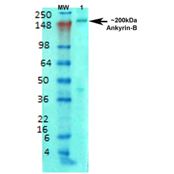Ankyrin B Antibody (HRP)