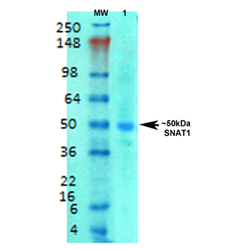 SLC38A1 Antibody (Biotin)