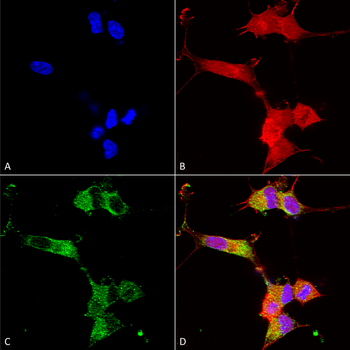 NALCN Antibody (Biotin)