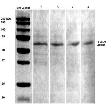 ASIC1 Antibody (FITC)