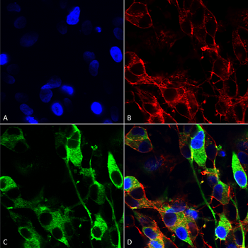 Versican Antibody (Biotin)