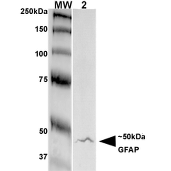 GFAP Antibody (HRP)