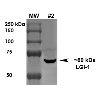 LGI1 Antibody (FITC)