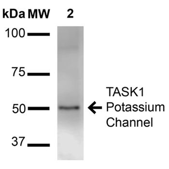 KCNK3 Antibody (PerCP)