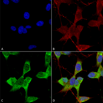 KCNK3 Antibody (RPE)