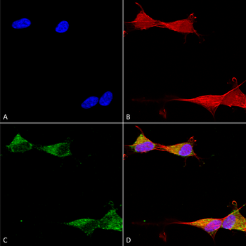 Ataxin 1 Antibody (Biotin)