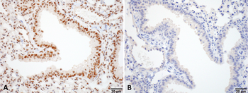 HSF1 Antibody