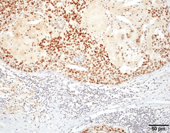 HSF1 Antibody (Biotin)