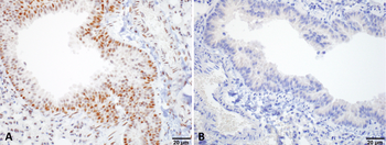 HSF1 Antibody