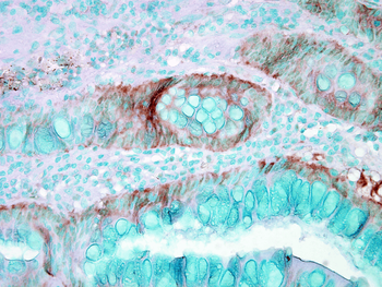 HSP70 Antibody (HRP)