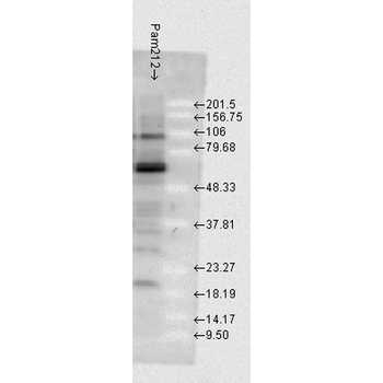 HSP70 Antibody (RPE)