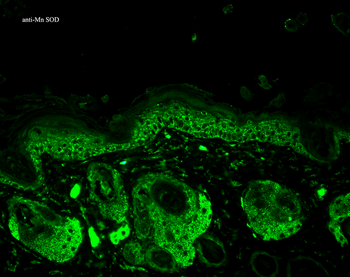 SOD2 (Mn) Antibody (FITC)
