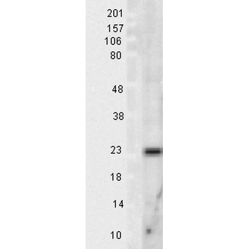 SOD2 (Mn) Antibody (HRP)