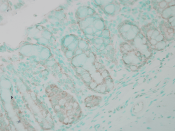 Ubiquitin Antibody (HRP)