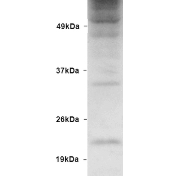 Ubiquitin Antibody (RPE)